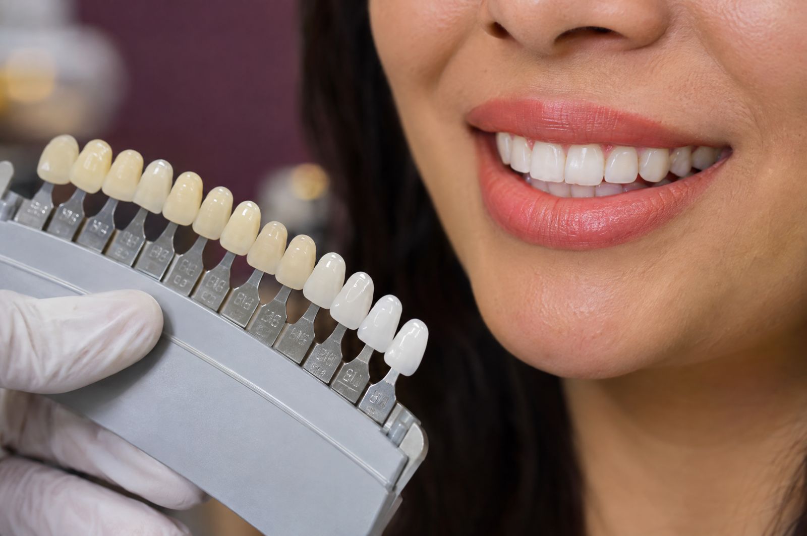 El dentista compara la guía de tonos junto a la sonrisa de una paciente
